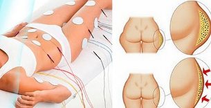 миостимуляторлардың артықшылықтары